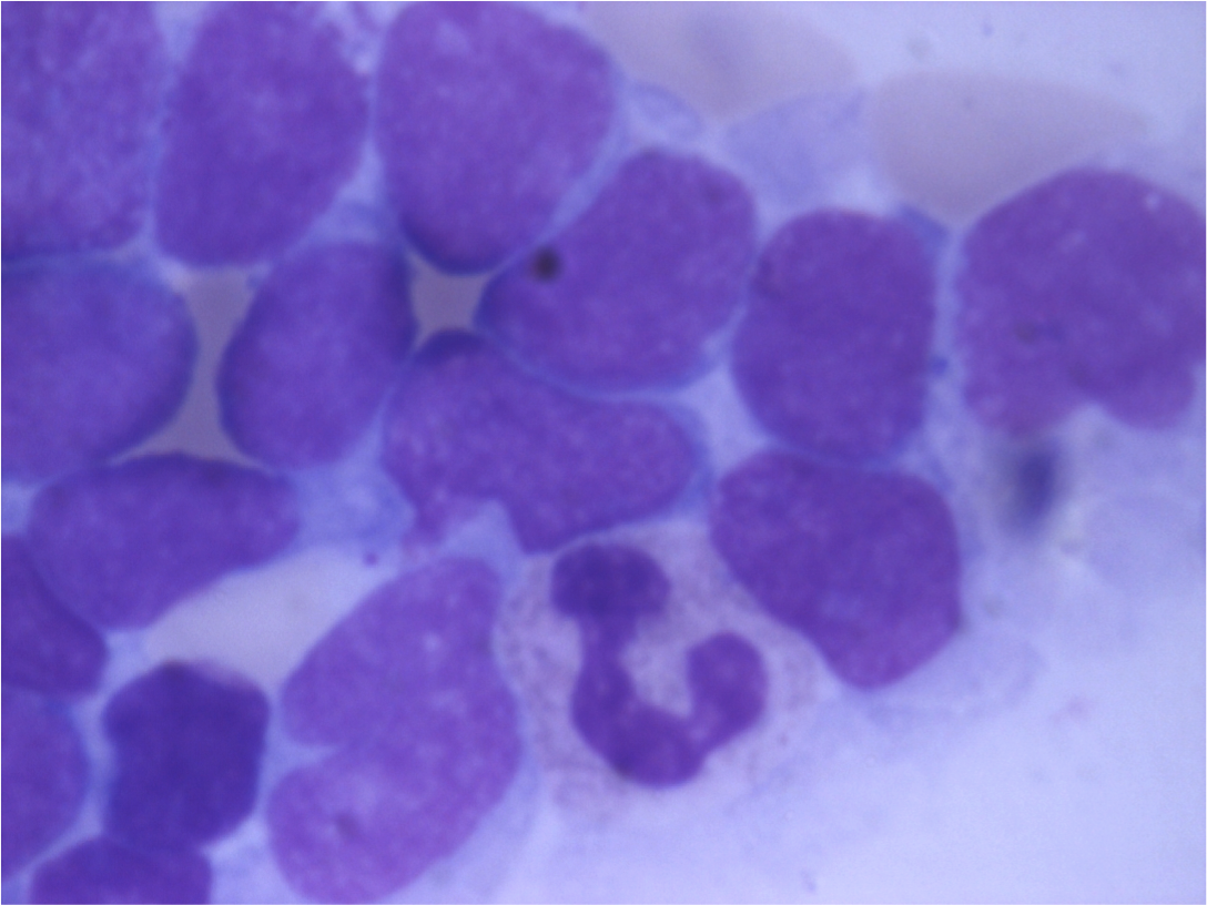 BM smear